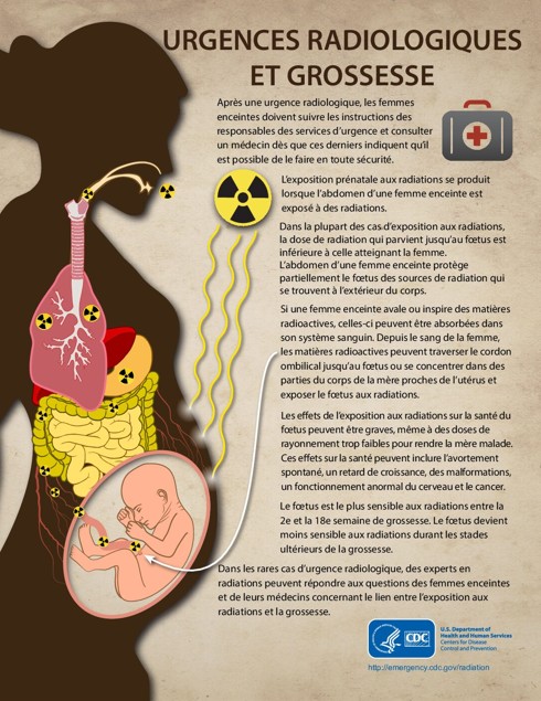 Urgences radiologiques et grossesse (infographie du CDC)